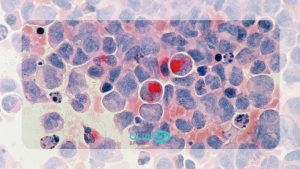 انتقال hpv